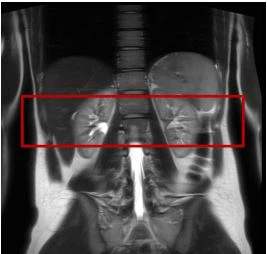 Cistanche for kidney
