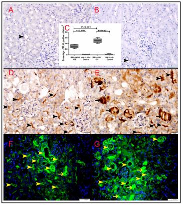 Fig. 8. A. Representative section  from kidneys of saline control GAL- 3 wild mice showing focal very low  cytoplasmic expression of MLKL  in few renal tubules (arrowhead).  B. Representative sections from  kidneys of saline control GAL-3 KO  mice showing focal very low cyto-plasmic expression of MLKL in few  renal tubules (arrowhead).