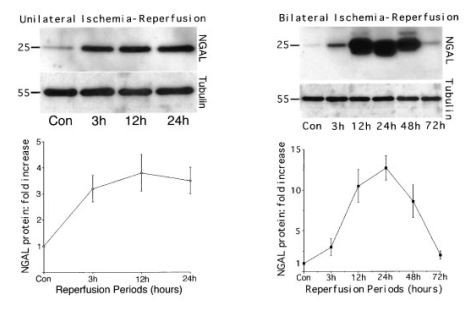 Cistanche can treat renal injury Cistanche can treat renal injury