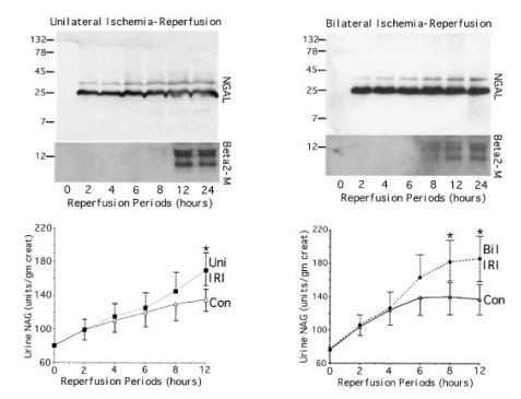 Cistanche can treat renal injury Cistanche can treat renal injury