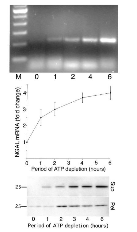 Cistanche can treat renal injury Cistanche can treat renal injury