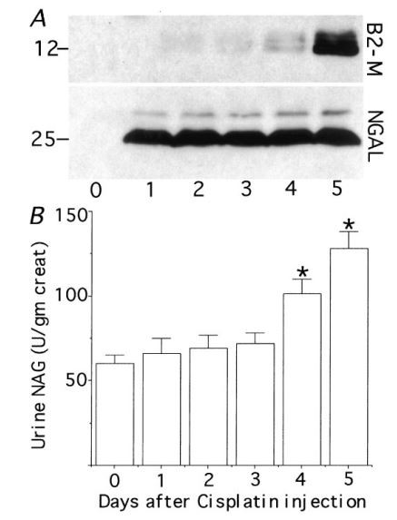 Cistanche can treat renal injury Cistanche can treat renal injury