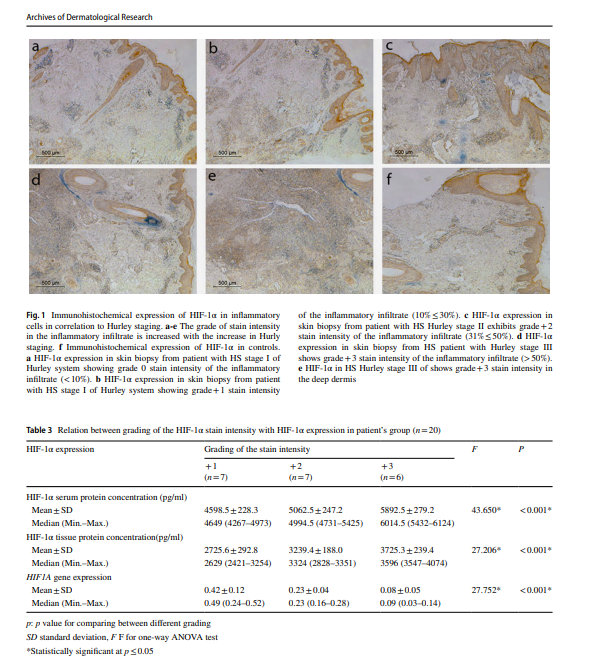 where to buy cistanche
